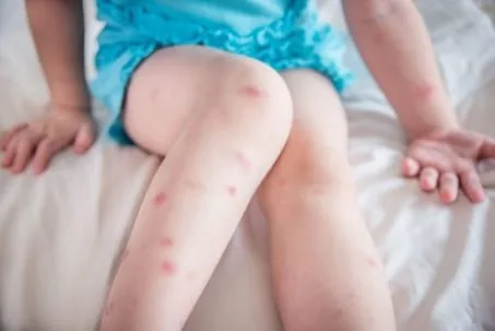 Beware Of Bed Bugs!